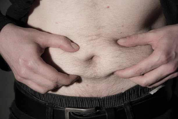 istock overweight man showing his belly 1295969816