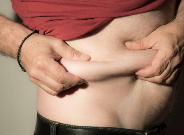 istock overweight man showing his belly 1295969876