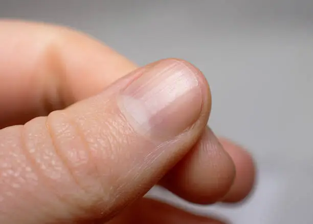 Very short cut nails. Finger is in the bottom left corner. Light gray background. Lunula is very well seen.