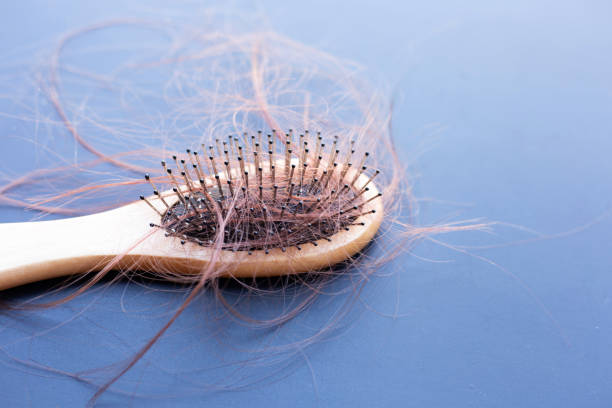 istock Hairs loss fall in comb on dark background. 1296218840