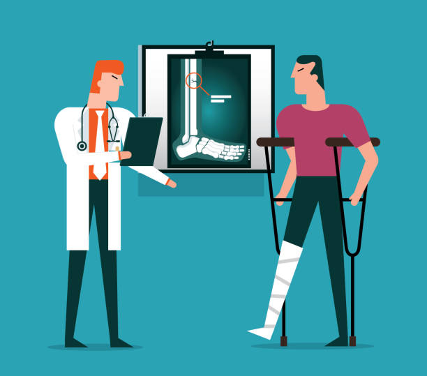 다리 의 골절 - 남성 - x ray human knee orthopedic equipment human bone stock illustrations