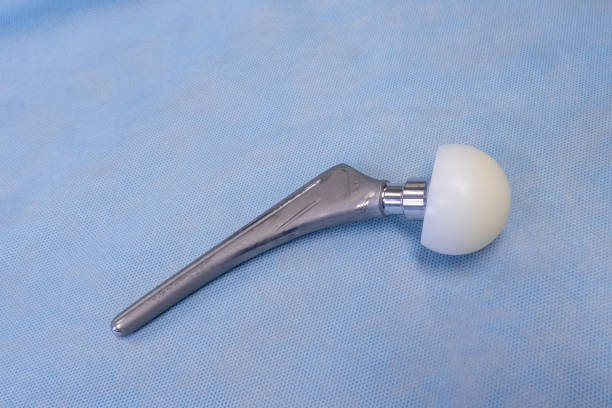 an explanted surgical hip prosthesis lies on an operating table explanted surgical hip prosthesis lies on an operating table hip replacement stock pictures, royalty-free photos & images