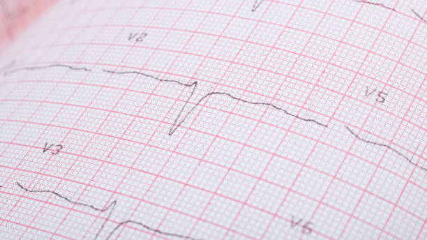 istock Cardiogram lines on pink paper close up 1296279009