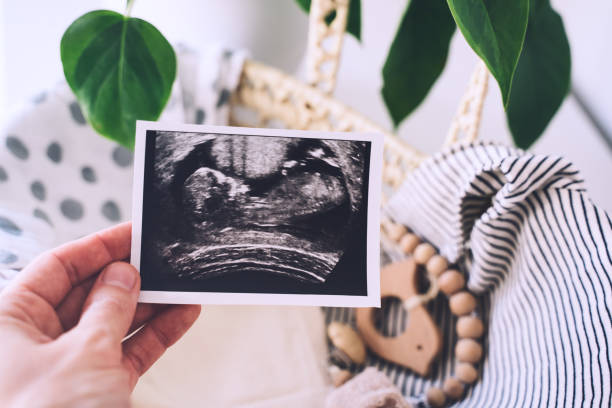 mano de mujer sosteniendo imágenes de ultrasonido en el fondo de la cesta de mimbre de cosas para el bebé recién nacido. - wicker basket store gift shop fotografías e imágenes de stock