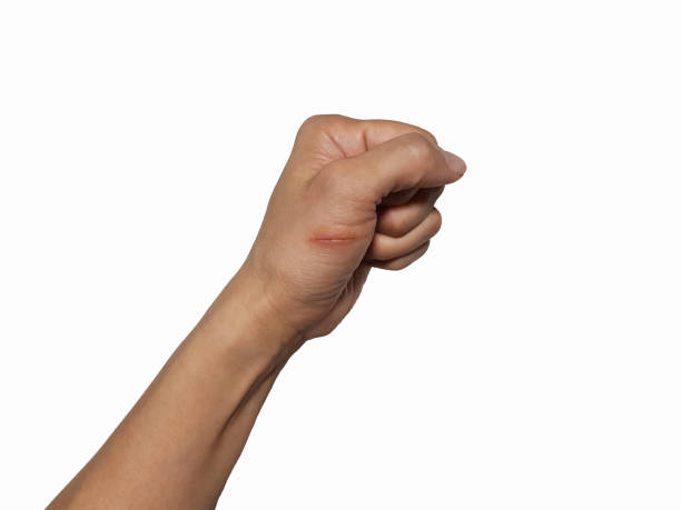 The hand has a knife wound The hand was wounded by a knife. On a white background scab arm stock pictures, royalty-free photos & images