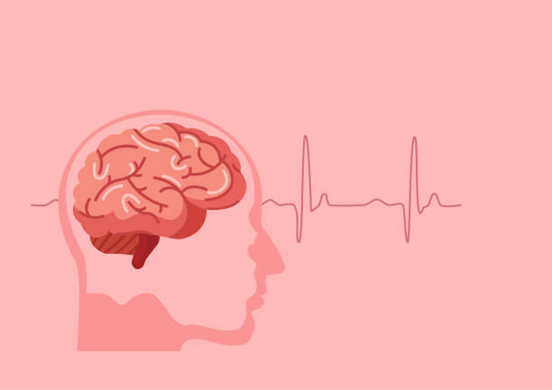 Human brain stroke illustration. Scientific medical illustration of human brain stroke illustration. Types of human brain stroke illustration. vector, esp headache stock illustrations