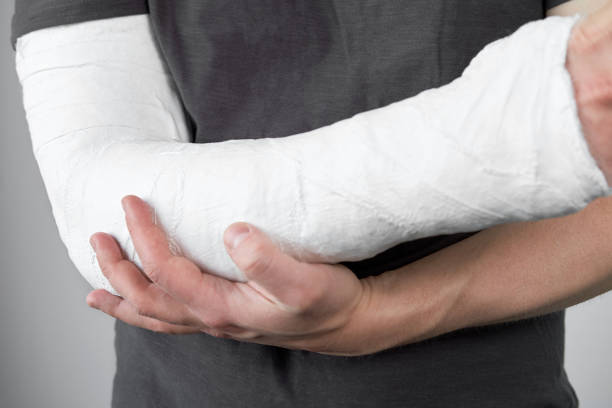 istock Closeup view of man's hand with plaster cast on a white wall background. 1296358950