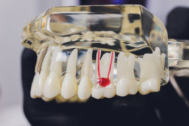 istock Orthodontist holds jaw in his hands for training. Package with capillaries, roots, pins. 1296420372