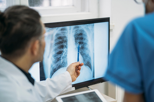 Primer plano de los médicos que analizan la película radiológica de rayos X del tórax photo