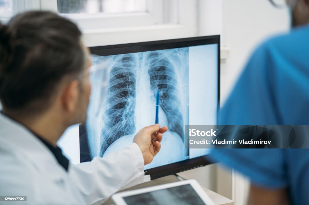 Close up of doctors analysing radiological chest x-ray film Doctors analysing radiological chest x-ray film during CODIV-19 pandemic Lung Stock Photo