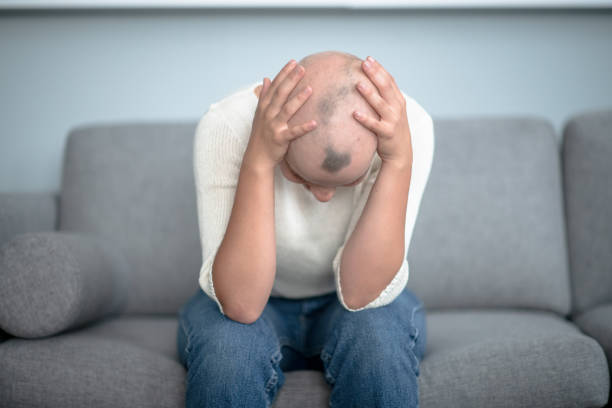 jeune femme frustrée avec l’alopécie - balding photos et images de collection