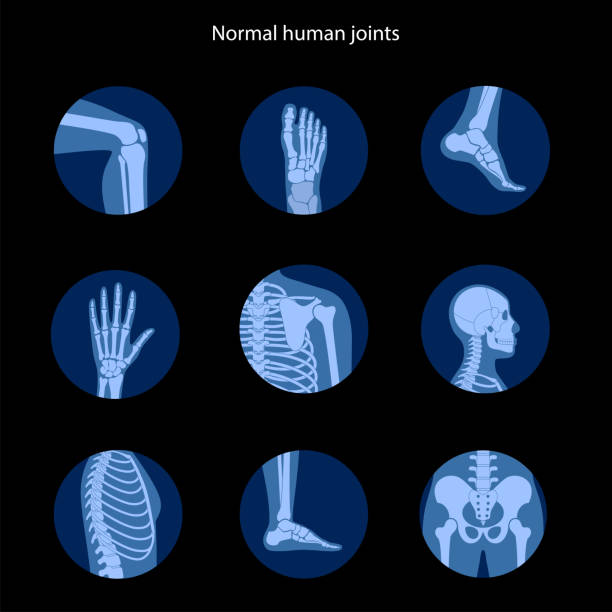 Arthritis Sets 2 Spine, knee, skull and other human joints icon. Normal bones anatomy. Skeletal x ray medical poster. Orthopedic or chiropractic treatment. Anatomical logo for clinic. Isolated flat vector illustration pelvis icon stock illustrations