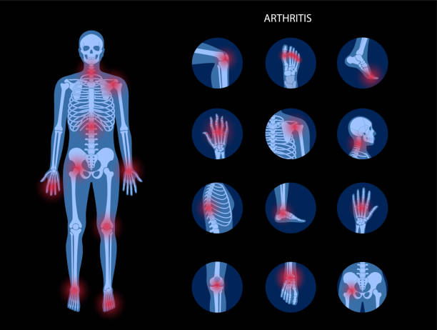 관절염 세트 2 - human bone the human body healthcare and medicine human skeleton stock illustrations
