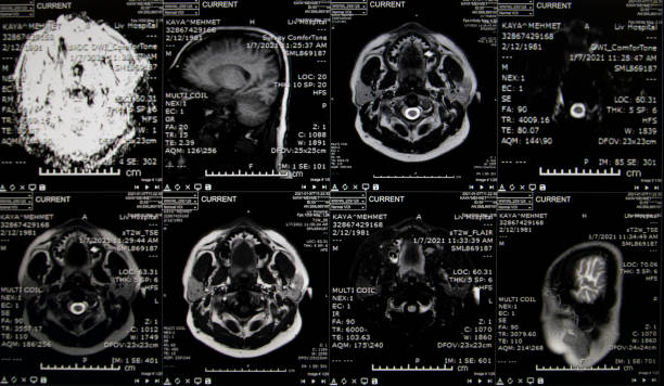 imágenes de resonancia magnética del cerebro (cerebro de rmn). - head shoot fotografías e imágenes de stock