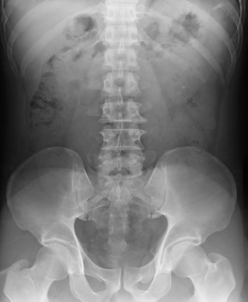 imagens de raio-x da coluna vertebral - cat scan pelvis hip human spine - fotografias e filmes do acervo