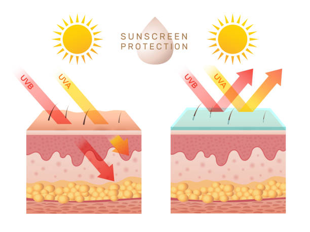 ilustraciones, imágenes clip art, dibujos animados e iconos de stock de protección uv de la piel. damaged piel humana se pela antes y después de la protección solar cuerpo capas adiposas epidermis reciente plantilla infográfica vectorial - luz ultra violeta