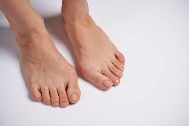 白い背景にスレートを閉じる女性の足のhlluxバルガス - misalignment ストックフォトと画像