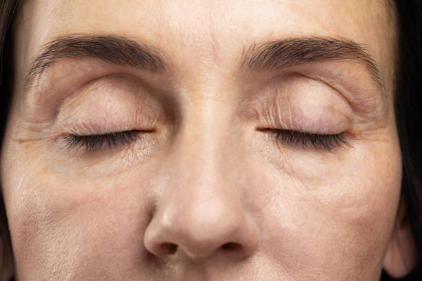 Tired eyes of middle aged woman Tired eyes of middle aged woman. Concepts of aging, cosmetology and health. dehydration eye stock pictures, royalty-free photos & images