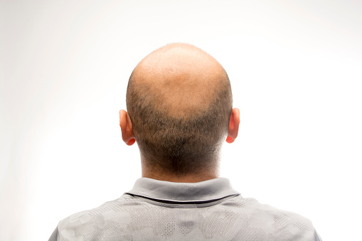 Back view of bald head stock photo