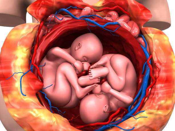 podwójny płód w łonie matki - twin fetus uterus human pregnancy zdjęcia i obrazy z banku zdjęć