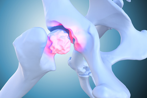 Canine Arthritis and Osteoarthritis joint inflammation, deterioration of joint in dogs, 3d illustration