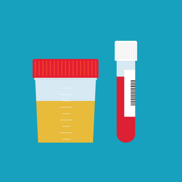 実験室分析のための尿および血液サンプル - doping test点のイラスト素材／クリップアート素材／マンガ素材／アイコン素材