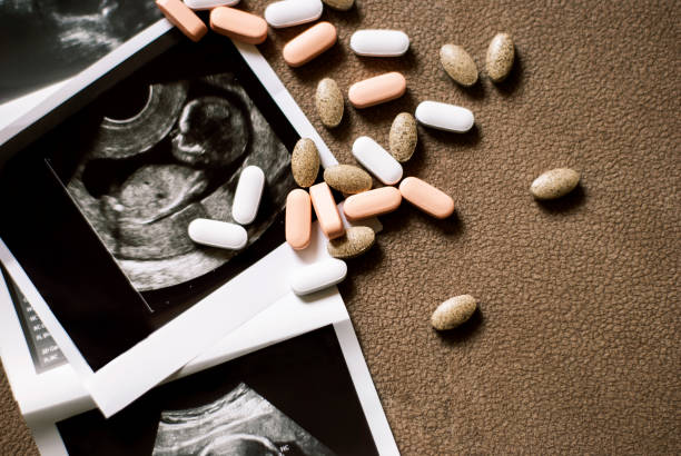 photo du foetus sur un balayage d’ultrason et peu de pillules sur le fond brun - foetus étape de fécondation humaine photos et images de collection