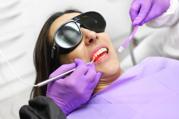 dentiste utilisant un laser dentaire moderne de diode. photo de haute qualité - laser photos et images de collection