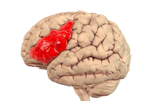 Human brain with highlighted inferior frontal gyrus, 3D illustration. It is a part of the prefrontal cortex and the location of Broca's area, involved in language processing and speech production