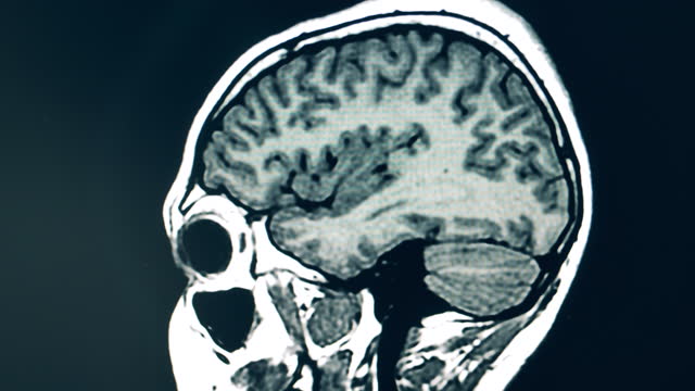 Dynamic image of human brain during CT scanning