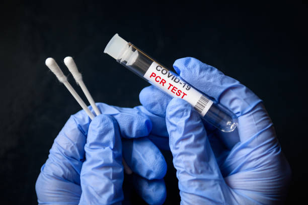 COVID-19 swab collection kit in doctor hands, nurse holds tube of coronavirus PCR test stock photo