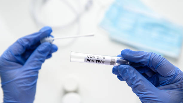 test to coronavirus in doctor hands, nurse holds tube of covid-19 swab collection kit - pcr device imagens e fotografias de stock