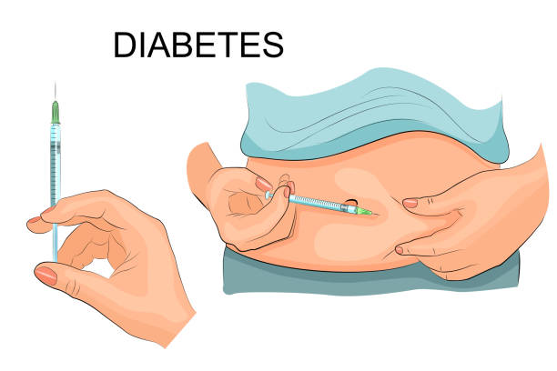 ilustrações de stock, clip art, desenhos animados e ícones de insulin injection in a belly. vector illustration. - syringe vaccination vial insulin