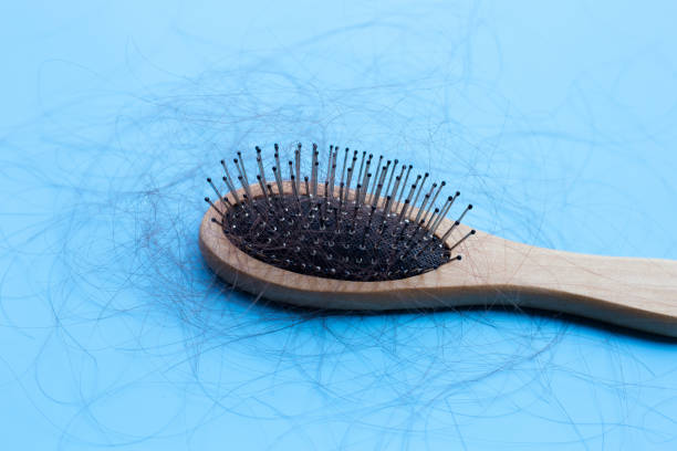 istock Hairs loss fall in comb on blue background. 1298091876