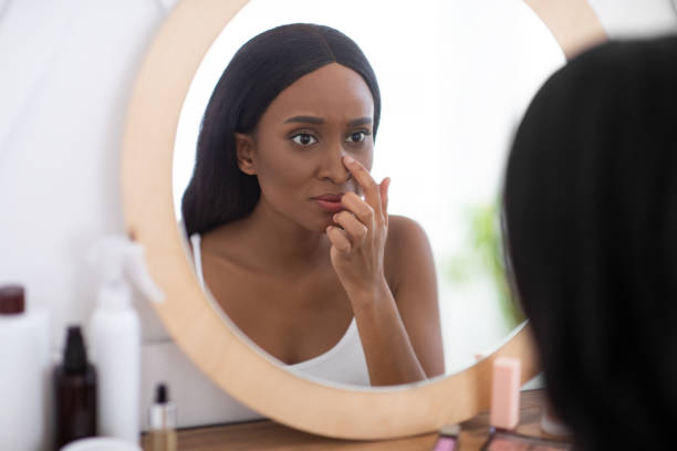 Problem skin during menstruation, acne, pimples and hyperandrogenism Problem skin during menstruation, acne, pimples and hyperandrogenism. Sad young african american woman looks in mirror and unhappy with big pores on nose at home in interior of bedroom in morning huge black woman pictures stock pictures, royalty-free photos & images