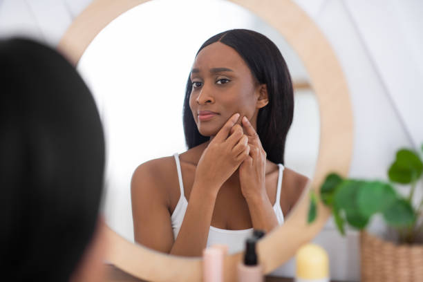 istock Acne treatment, squeezing, spot, skin care, pressing on skin problem face 1298255586
