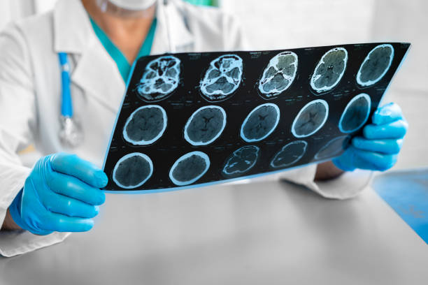 istock Man doctor examining head mri while sitting at the table in hospital 1298354213