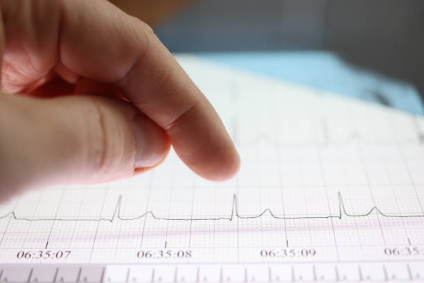 istock Thumb over tablet with heart cardiogram image 1298588879