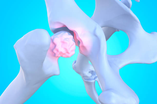 istock Canine Arthritis and Osteoarthritis joint inflammation, 1298645379