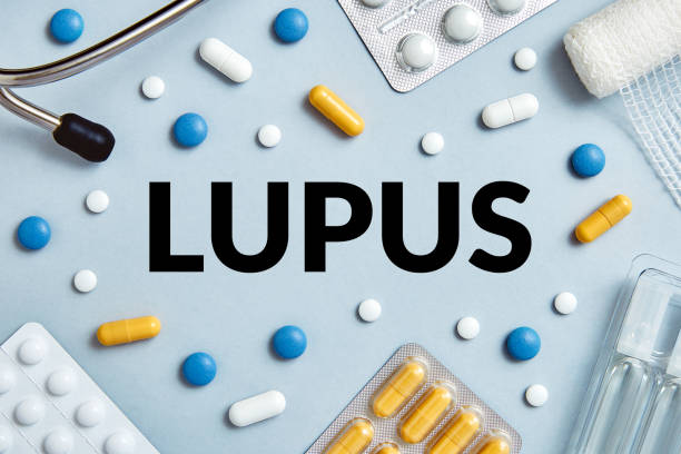 Lupus disease concept stock photo