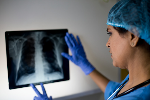 Female surgeon analyzing x-ray image and in hospital