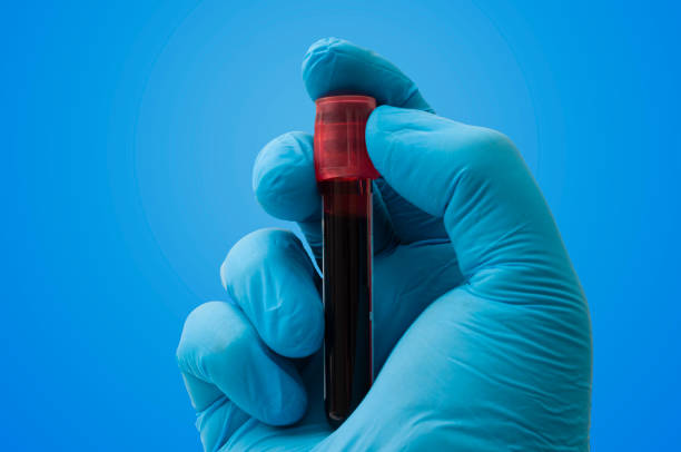 diagnostica di laboratorio, esaminare il concetto di microbiologia e test del plasma con il medico che tiene la provetta con campione di sangue in mano con guanti di lattice sterili isolati su sfondo blu e ritaglio del percorso di ritaglio - blood blood sample blood donation tube foto e immagini stock