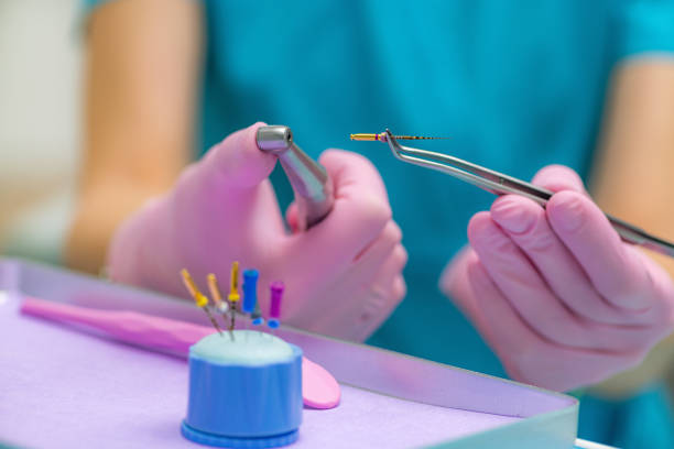 istock Preparing for Endodontic Root Canal Treatment 1298957600