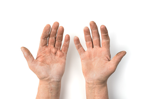 Adult hands smeared with work isolated on a white background. Concept of protection and assistance to the elderly.
