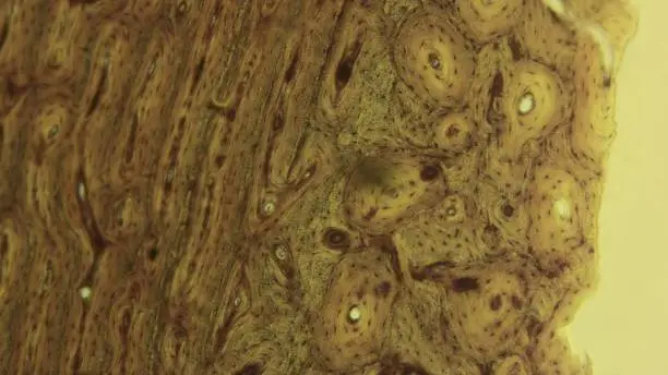 Photo of Cross section of a hollow bone under the microscope (400x)