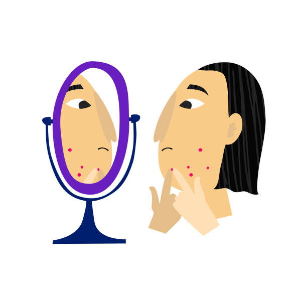 Young person looks in mirror and pops a pimple. Acne problem concept. Hand drawn character with facial blemish isolated on white background. Squeezing zit. Trendy stock vector illustration pimp stock illustrations