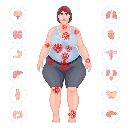 Fat woman suffering pain in different body parts. Pain map.