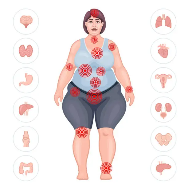 Vector illustration of Fat woman suffering pain in different body parts. Pain map.