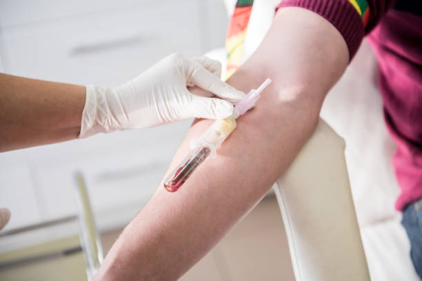 istock Nurse taking a patient's blood sample at lab 1299565273