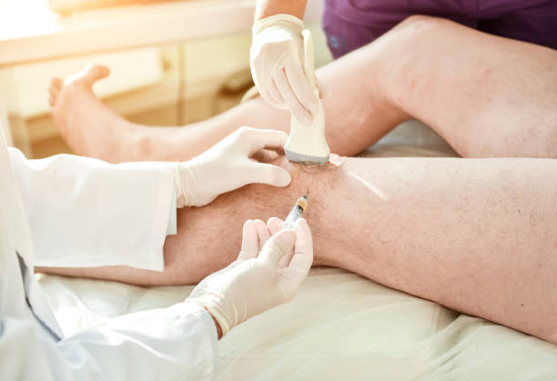 istock Ultrasound-guided platelet-rich plasma injection of the knee 1299568151